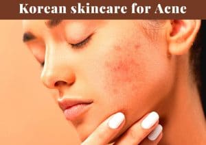 best korean skincare products for acne