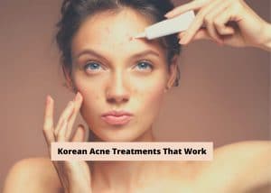 korean acne treatments