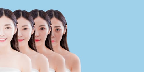 skin whitening before after