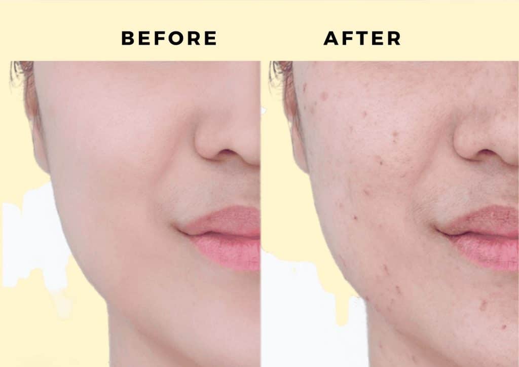 snail mucin before and after