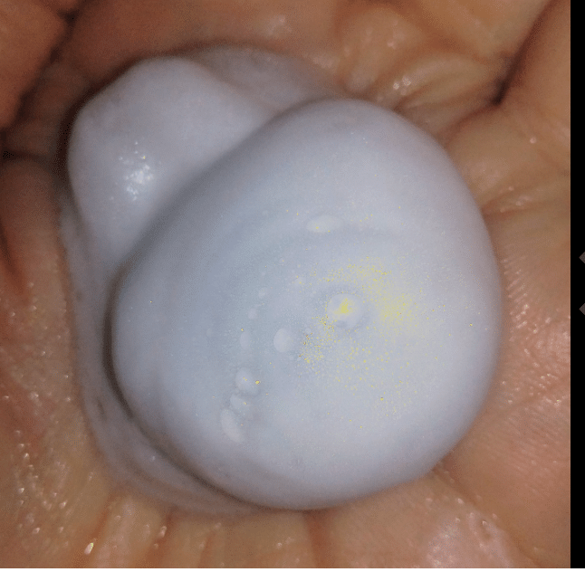 best face wash to clear acne
