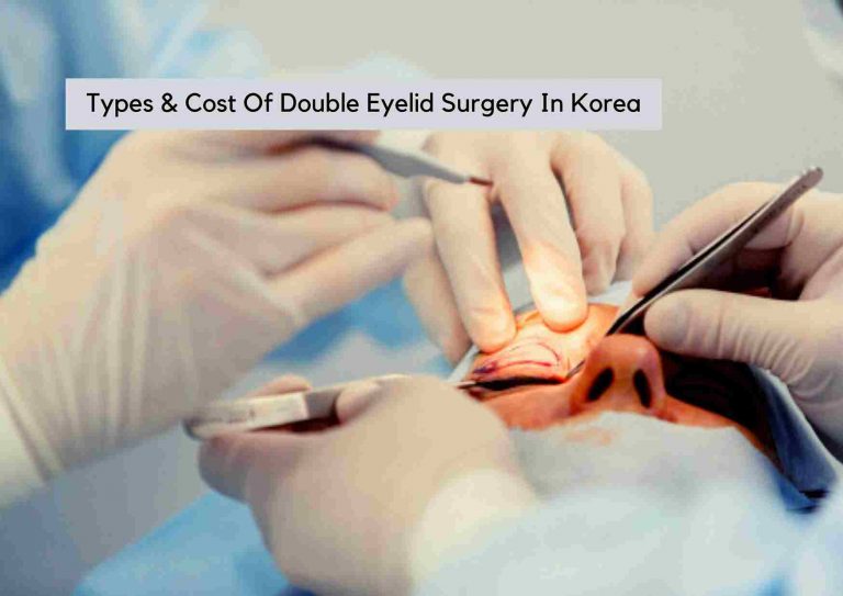 3 Main Types And Cost of Double Eyelid Surgery In Korea | Complete Guide