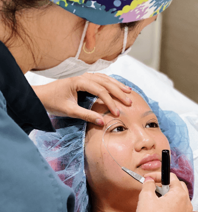 double eyelid surgery korea cost reddit